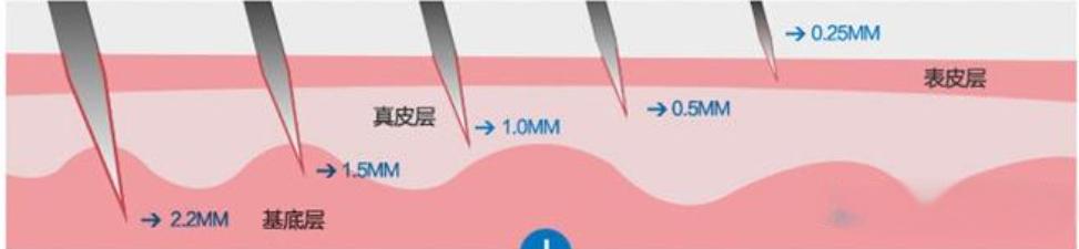 微针行业微量定量控制设备